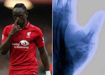 Liverpool – Blessure au pouce : 3 mois d&rsquo;arrêt pour Sadio Mané ?