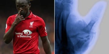 Liverpool - Blessure au pouce : 3 mois d'arrêt pour Sadio Mané ? - wiwsport