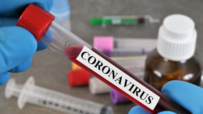 CHAN 2020: Un test de coronavirus avant d'entrer au Cameroun ! - wiwsport CHAN 2020: Un test de coronavirus avant d'entrer au Cameroun ! - wiwsport