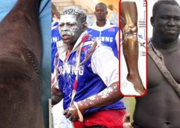 Vidéo- Opération du genou: Ali Ndiaye interpelle les lutteurs, parle du cas de Yekini et conseille Lac Rose - wiwsport