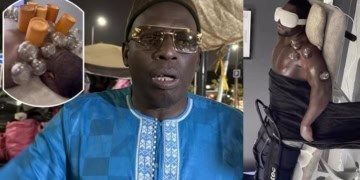 Blessure de Reug Reug : Son manager Palla Diop annonce une contre-expertise médicale - wiwsport